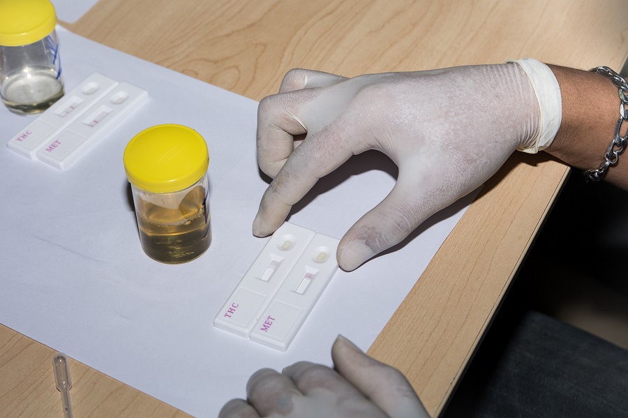 Learn the Difference between Urine and Hair Drug Tests