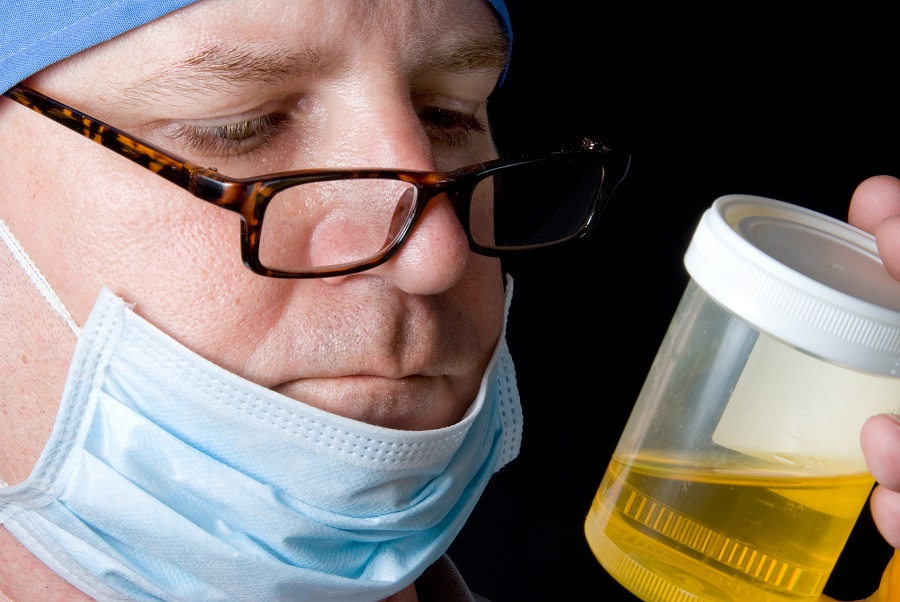 Doctor looking at urine sample cup