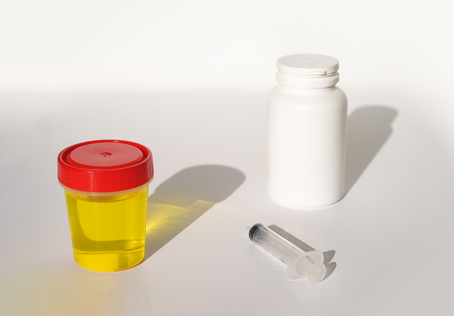 How Much Does a Urine Drug Test Cost?