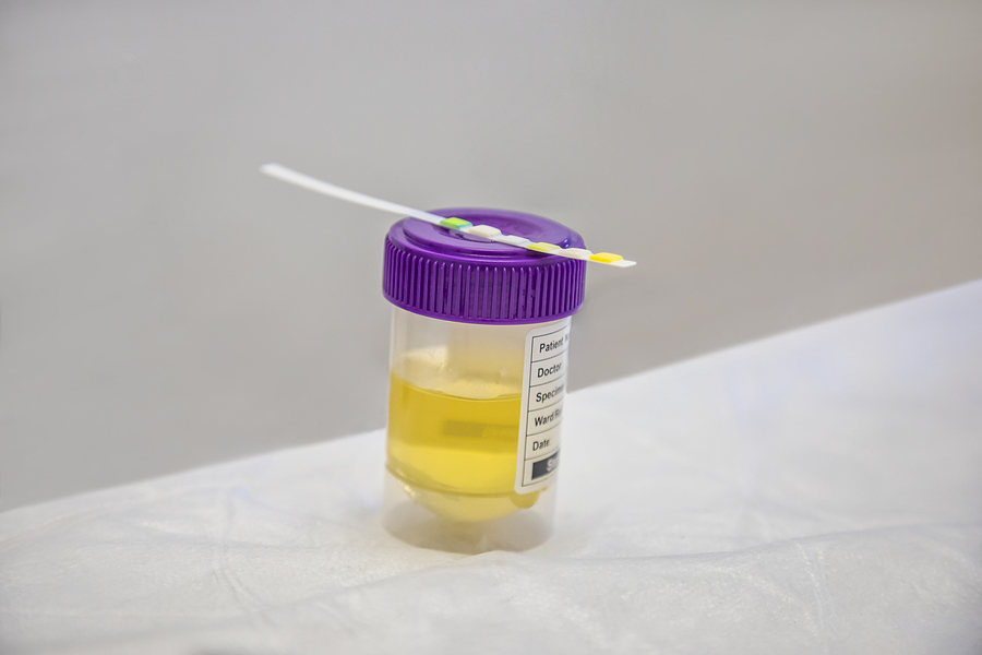 How Much Does Drug Testing Cost in Jackson, MS?