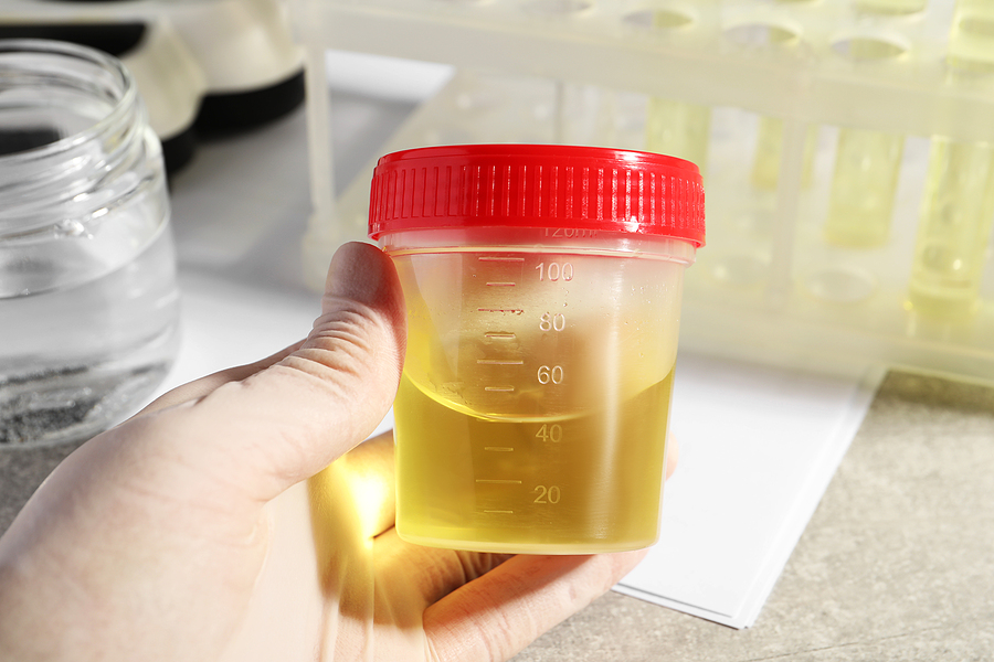 Drug Testing in the Workplace: Current Policies and Best Practices