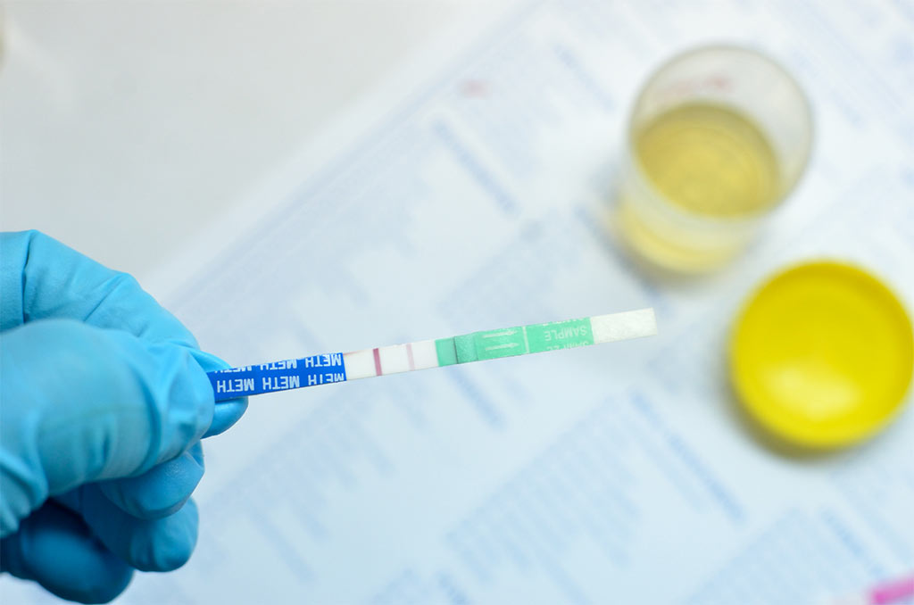 How Home Drug Testing Works: A Guide to Affordable Drug Tests in Jackson, MS