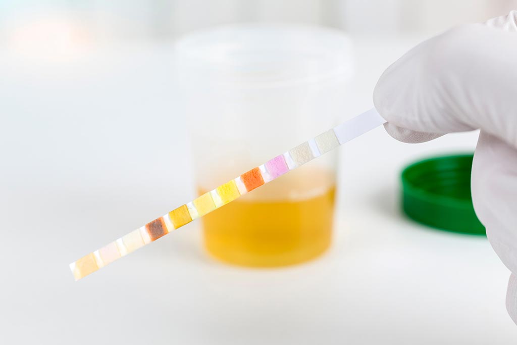 Urine Drug Testing Sample